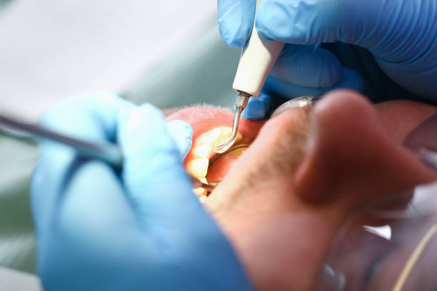 Best Broken or Cracked Tooth Emergency Dentist in Marysville, CA