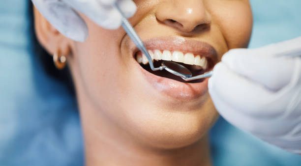 Emergency Dentist for Special Needs Patients